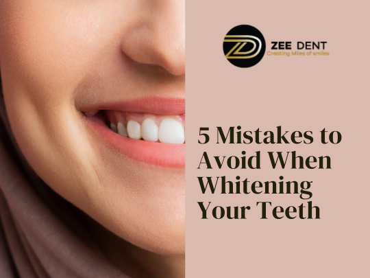 5 Mistakes to Avoid When Whitening Your Teeth