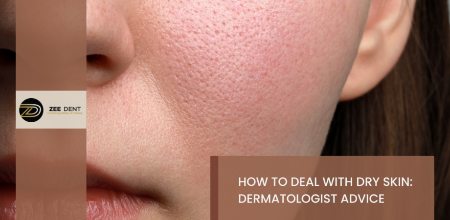 How to Deal with Dry Skin - Dermatologist Advice