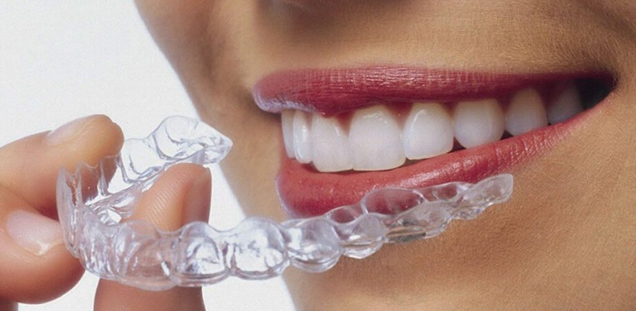 Invisalign for Teens
