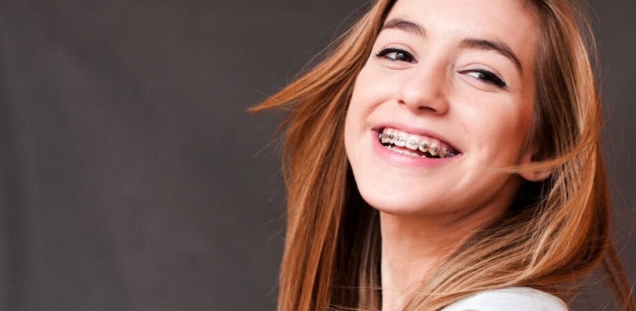 Straightening Smiles with Damon Braces