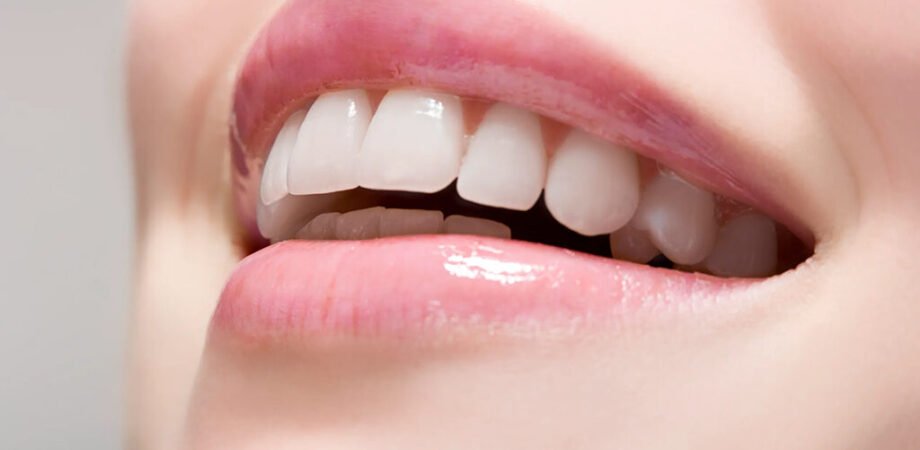 Teeth Whitening Options in Dubai
